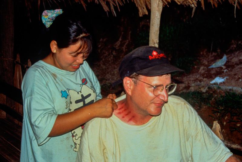 Bug spray Malaria is a major concern for anyone living or traveling in the jade-mines area. In this land of animism, the preferred local solution is embossing the skin by pinching it with a coin. The Maw-sisa miner at left is prepared for any kind of flying pest, as was Richard Hughes after he had the treatment applied. The efficacy of this bug protection was made crystal clear in Mogaung, where Hughes and Galibert slept side-by-side in the same bed. Come morning, Galibert's body was covered with bedbug bites, while Hughes was untouched.